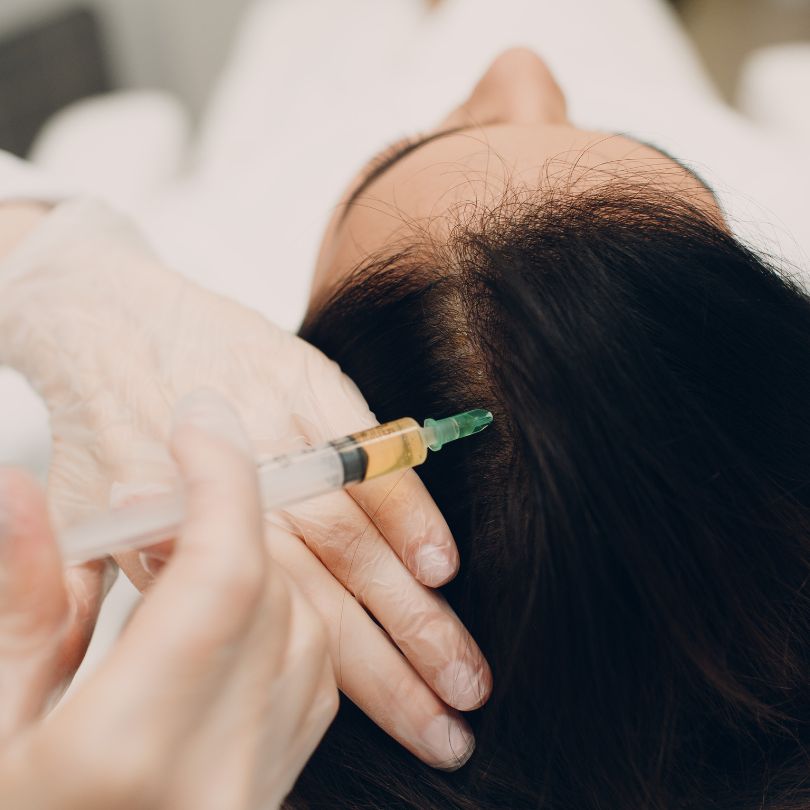 PRP Plasma lifting